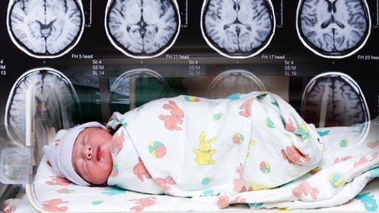 infant with brain scans behind them
