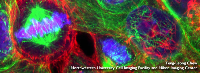 HeLa cells