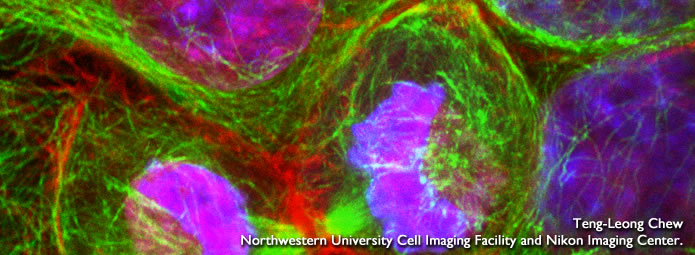 HeLa cells