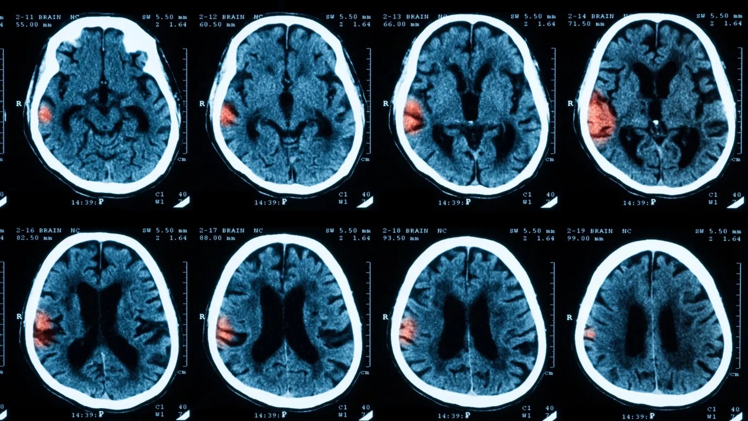 brain-scan.jpg