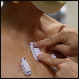 Image of chest with three devices