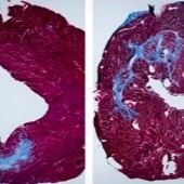 Samples of heart tissue 