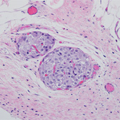 transplanted islets (darker purple) and the blood vessels (the red/dark pink areas are blood cells inside the blood vessels)